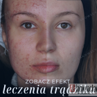 Fotka nr 0 z 4